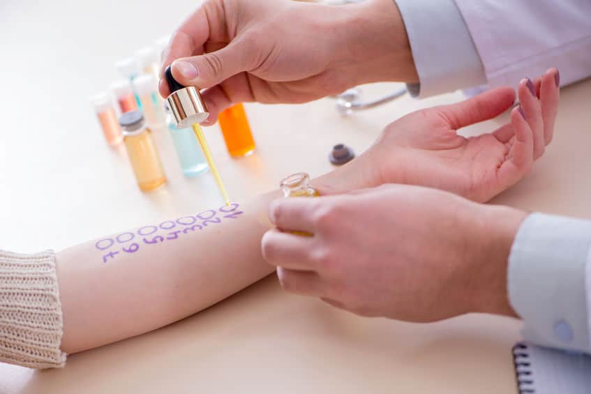 What to Expect During Allergy Testing